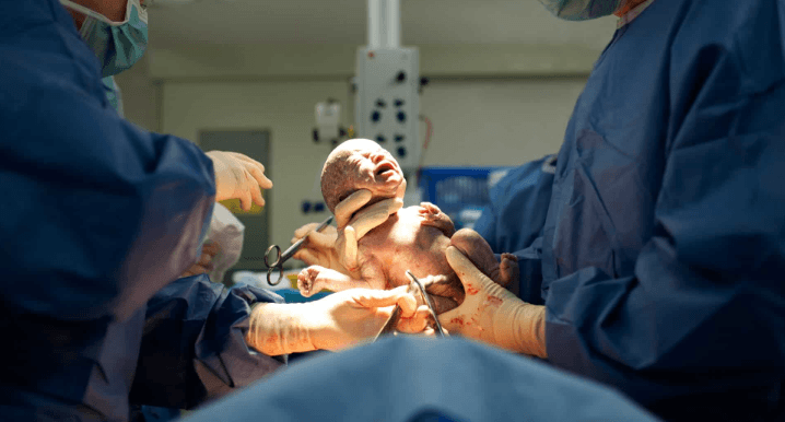 Birth Injury